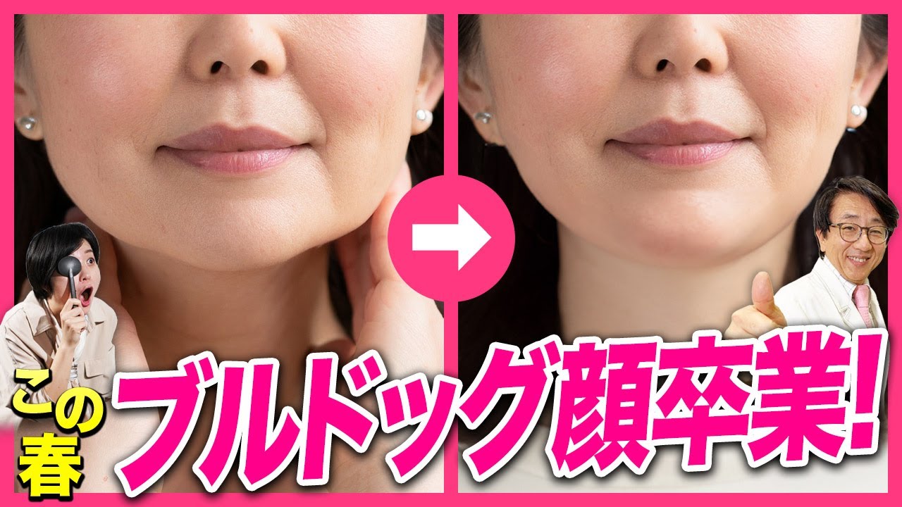 マスク外したらブルドッグ顔になっていた人！コレで改善出来ます！