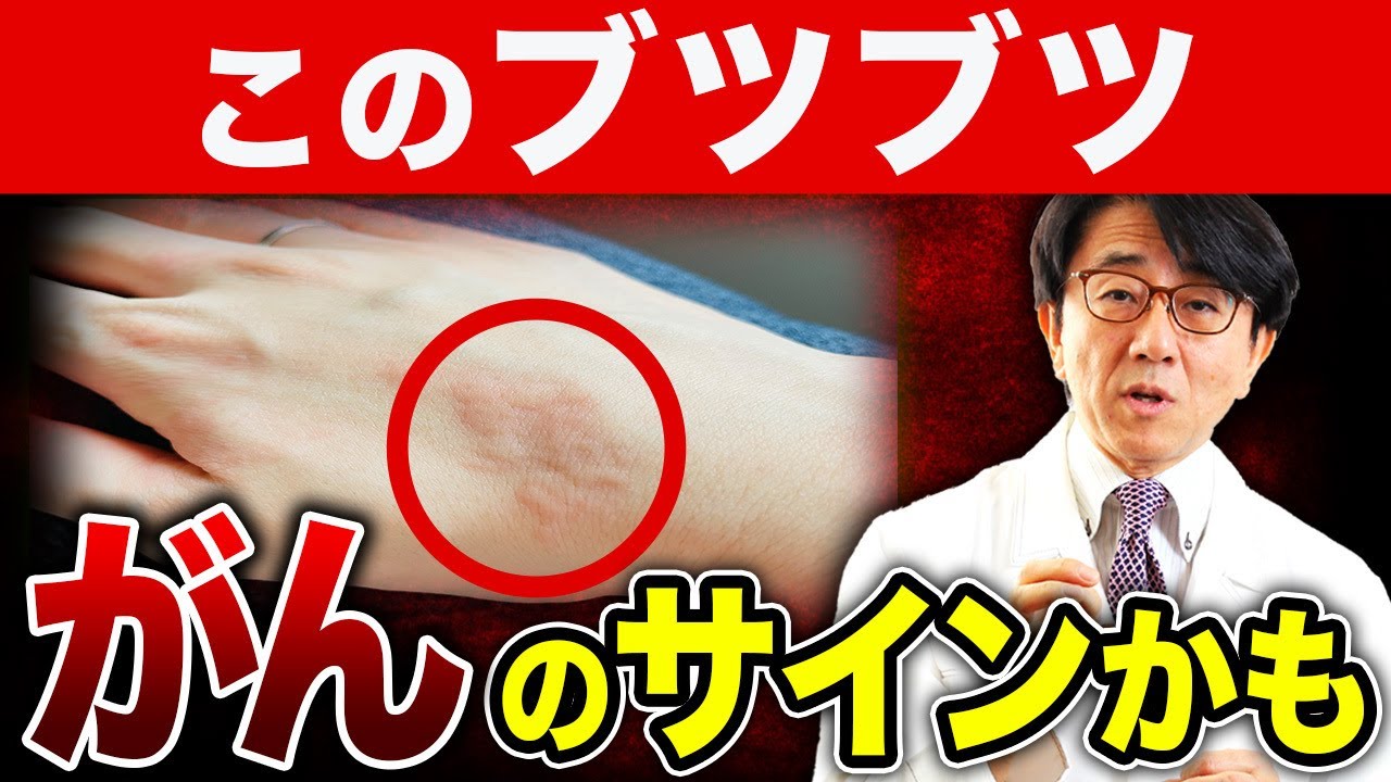 その「ブツブツ」実は危険？見逃せない皮膚病変とは【医師解説】