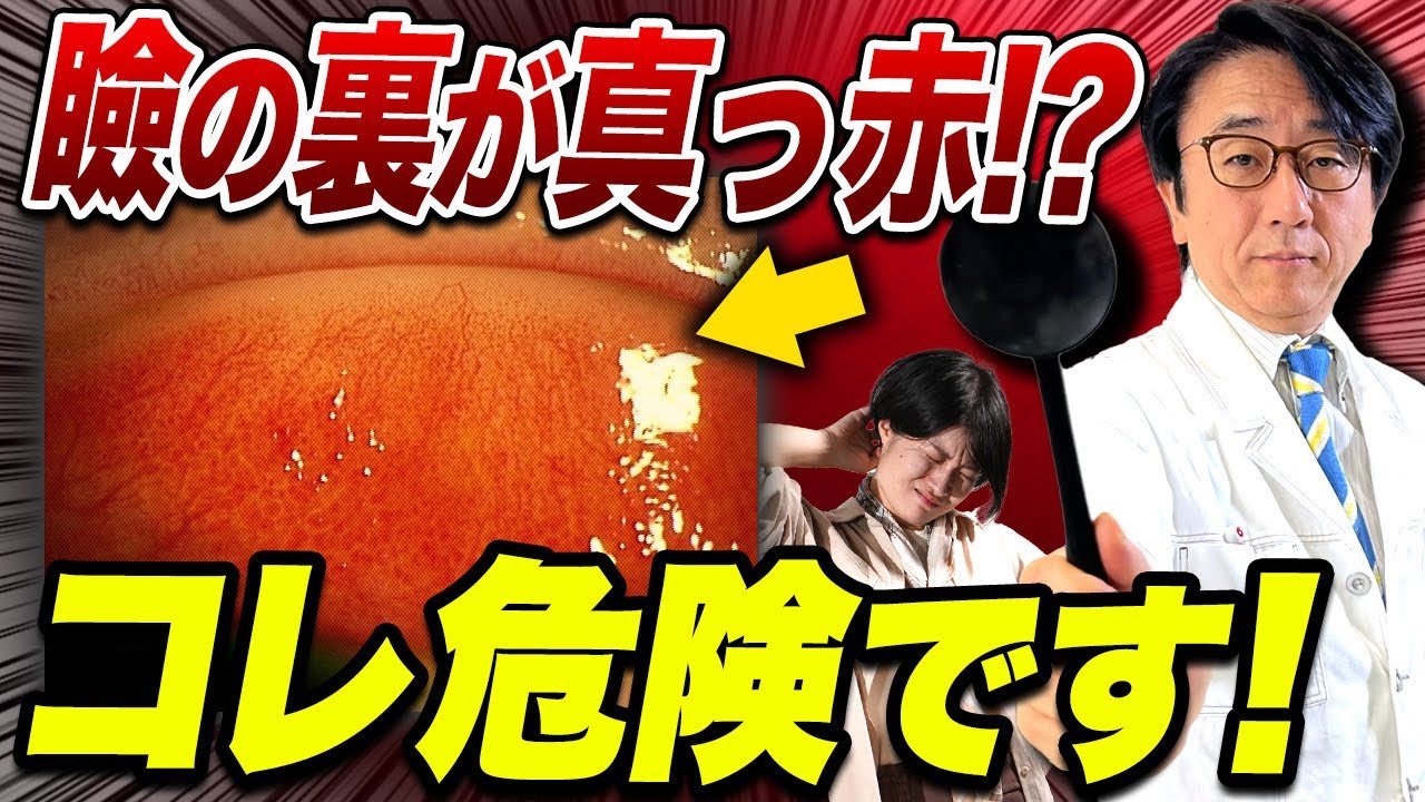 結膜炎だけでは済まない！実は怖いアノ病気だった！？