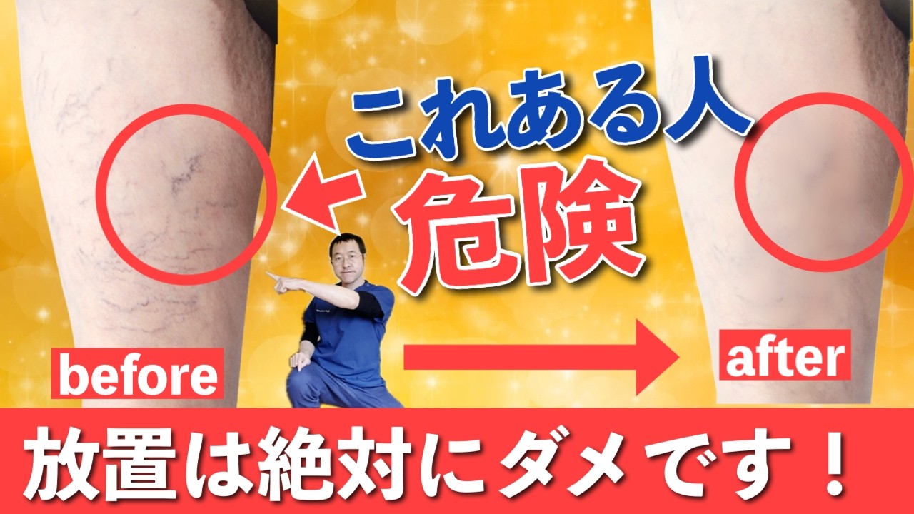 【１分押すだけで血流爆増】指先押すだけ簡単セルフケア