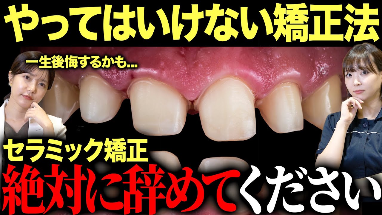【後悔します】セラミック矯正で歯を失う人が続出している理由を話します