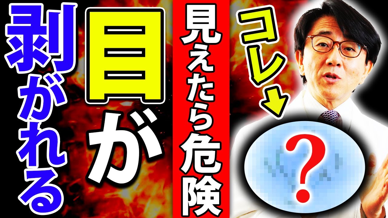 目の硝子体が破ける前兆！見逃さないで！【眼科医解説】