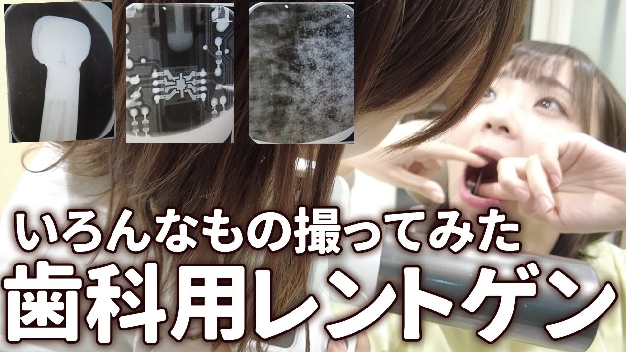 これなんでしょう！歯科用レントゲン！