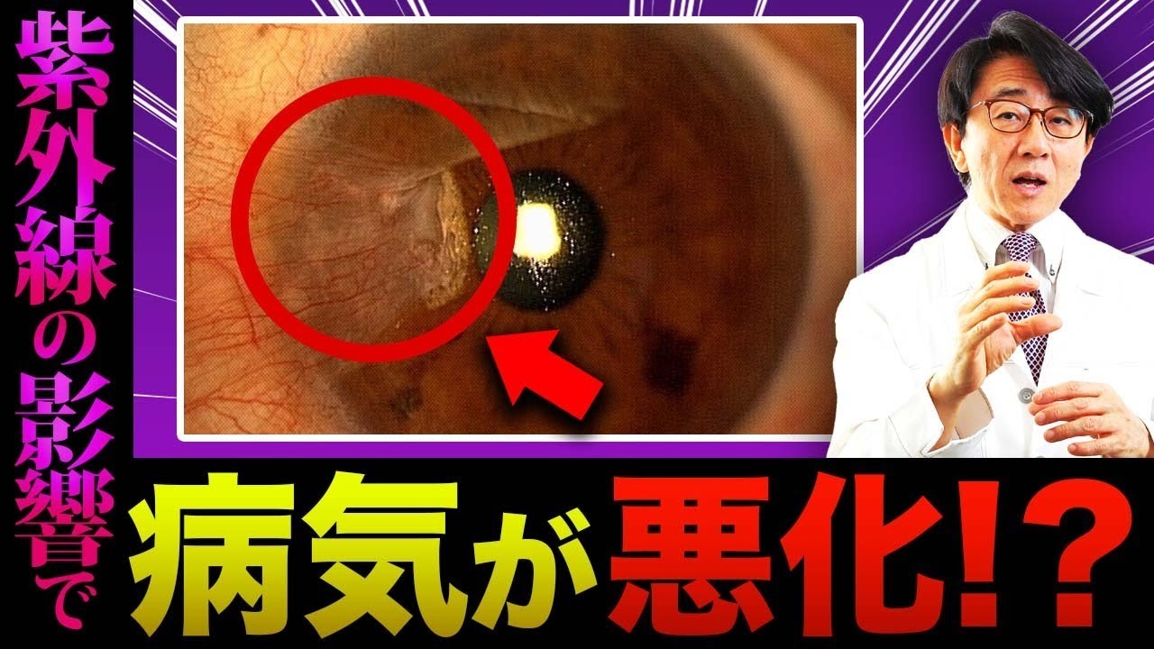 ほとんどの人が知らない紫外線と病気の関係性とは？