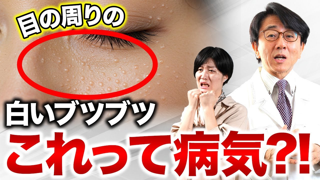【コレ絶対NG】稗粒腫ができてしまった時の正しい対処法を眼科医が解説します！