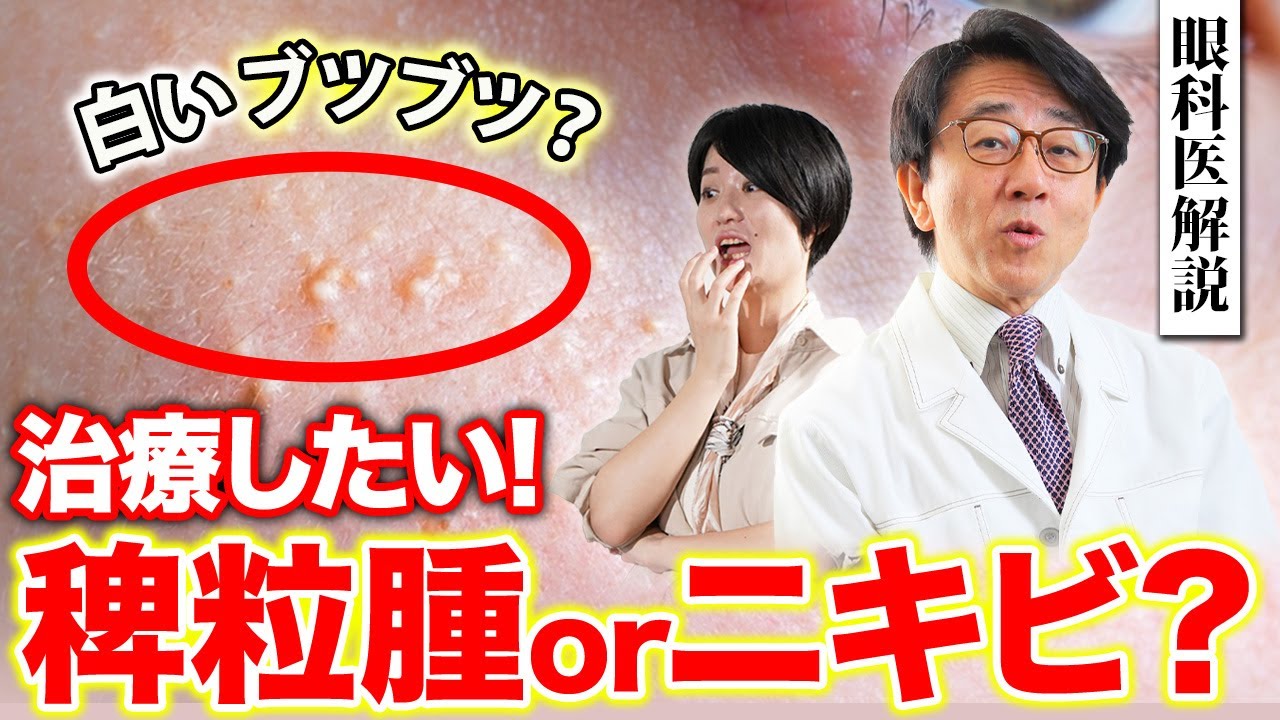 目の周りに出来やすいコレ！なに？