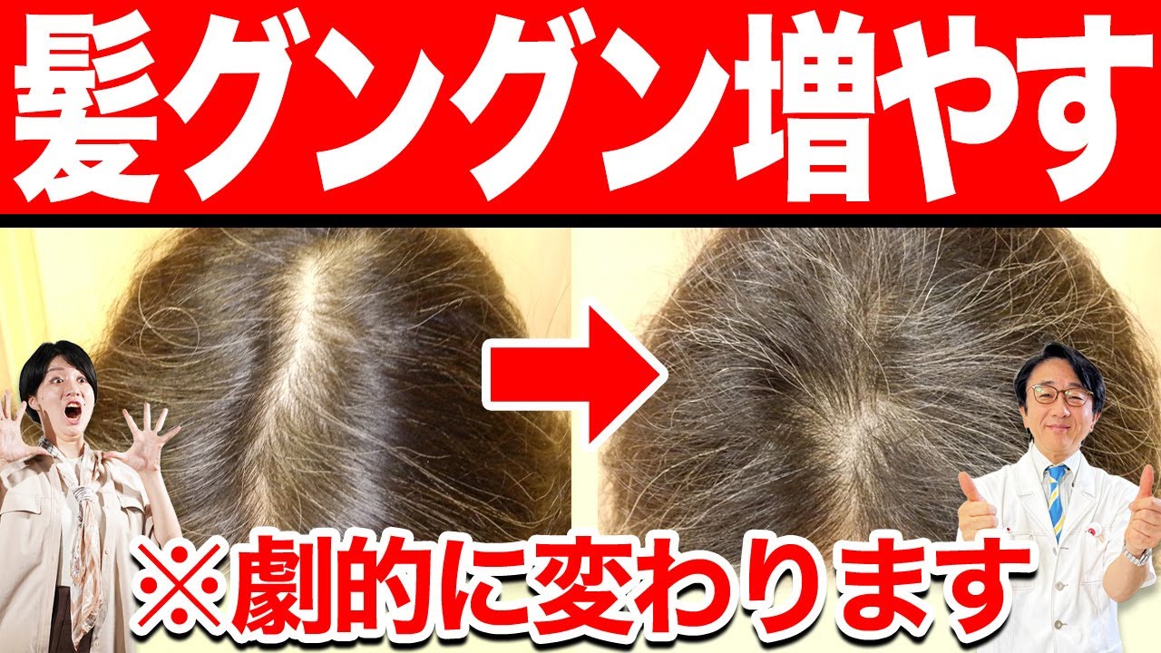 【薄毛治療】医療の力でしっかり髪を増やせます！