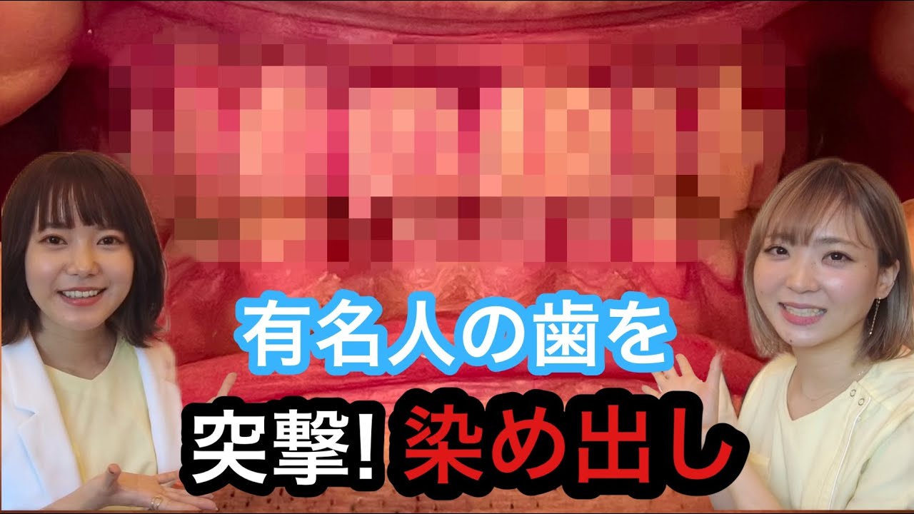 【徹底解説】ギネス保持者、指男の口の汚れ【染め出し】