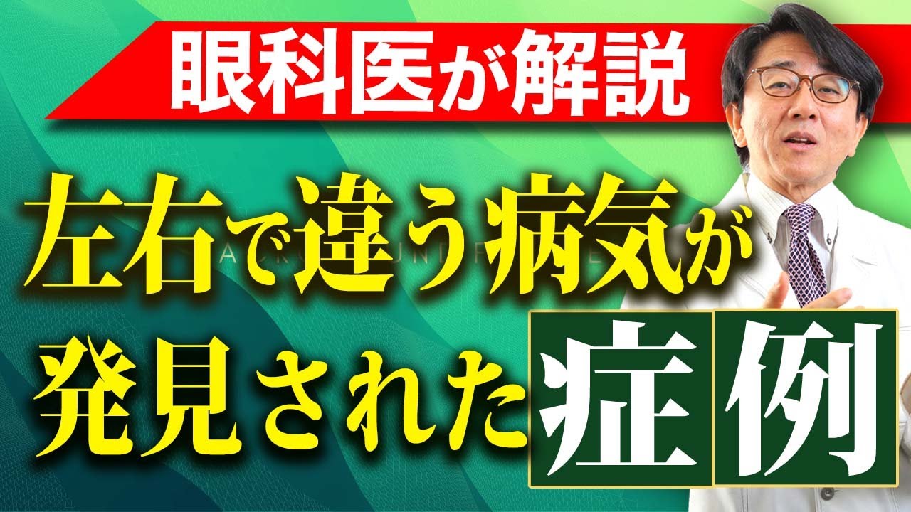 あなたの目、複数の病気を持っている可能性があります。