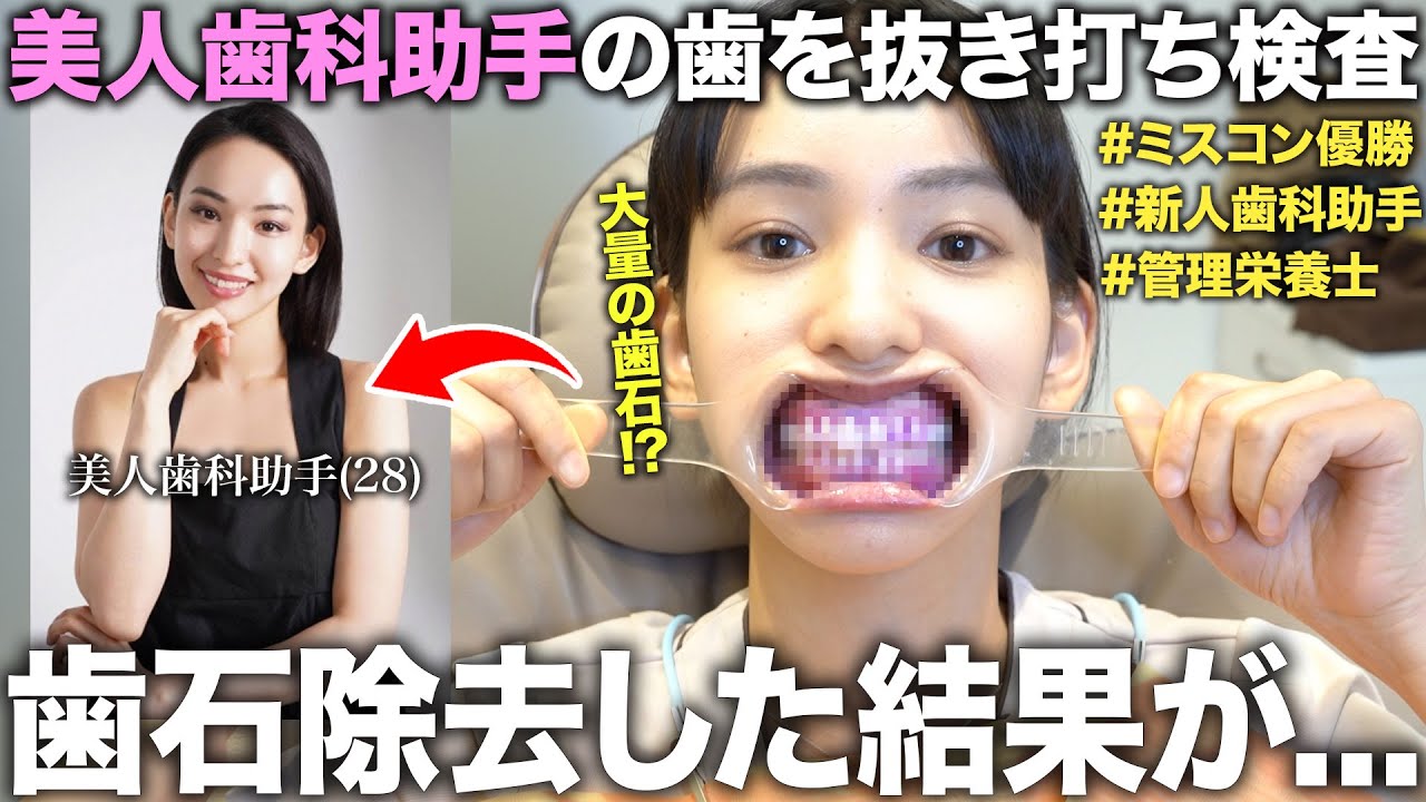 美人すぎる新人歯科助手の歯を仕事中に抜き打ち検査で歯石除去したら口の中がまさかの状態だった！？