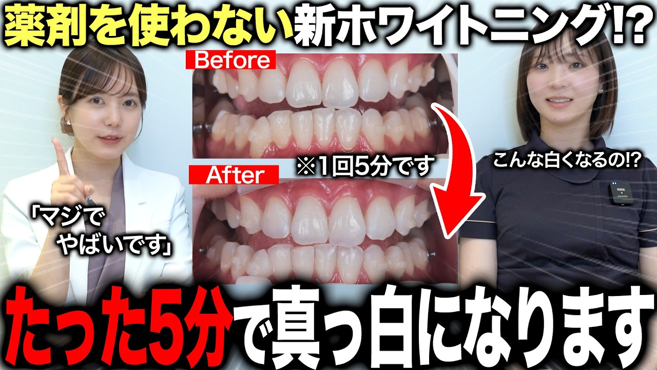 【医療ホワイトニングに革命！？】薬剤不使用のたった1回5分でて歯を白くする最新のトランセントホワイトニングがヤバすぎた...