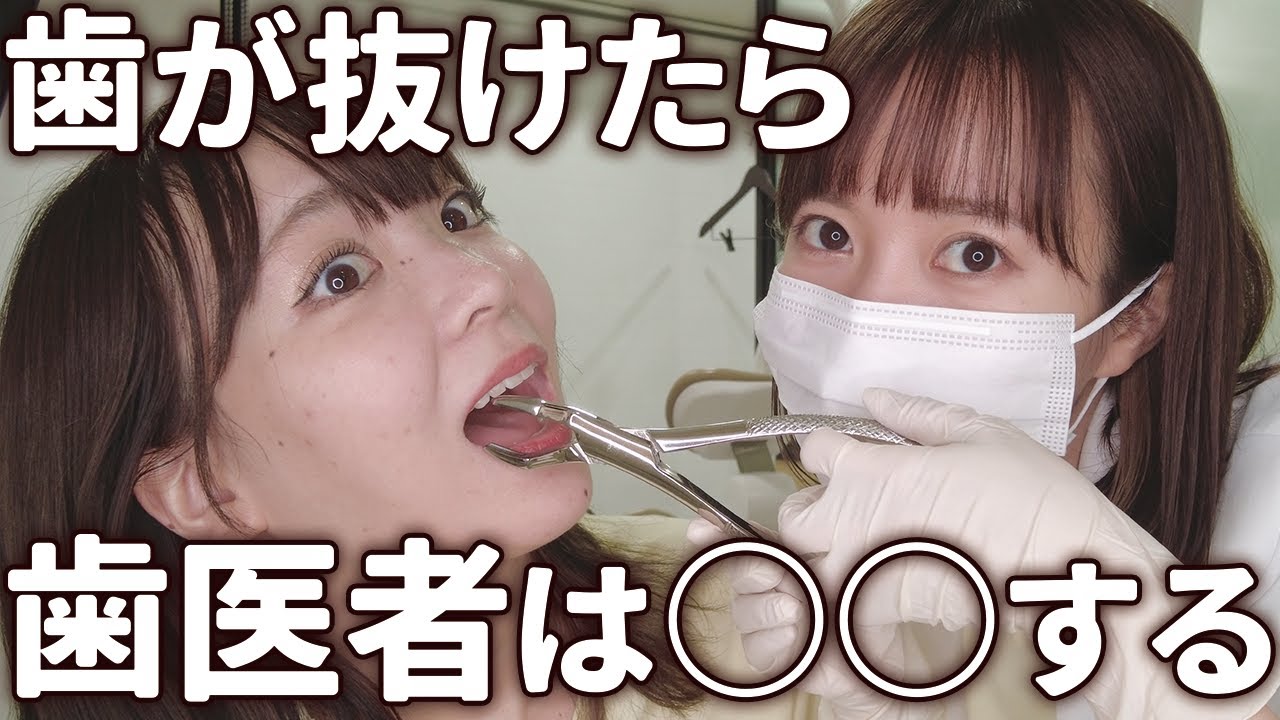 【本音】歯が抜けた時、歯科医師と歯科衛生士は何を入れる？【ぶっちゃけ】