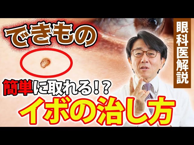 目の周りのイボ！こうやって治します。