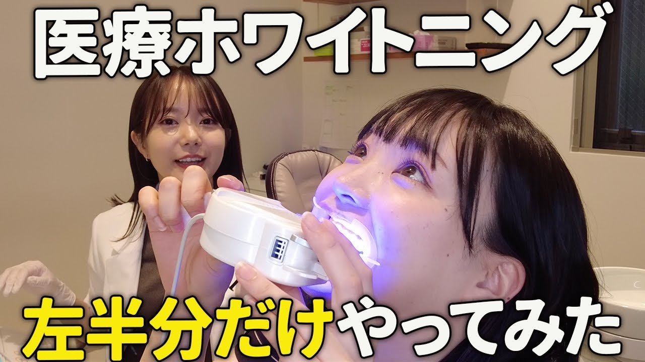【医療ホワイトニング】左半分だけやってみたら大変なことになりました...！