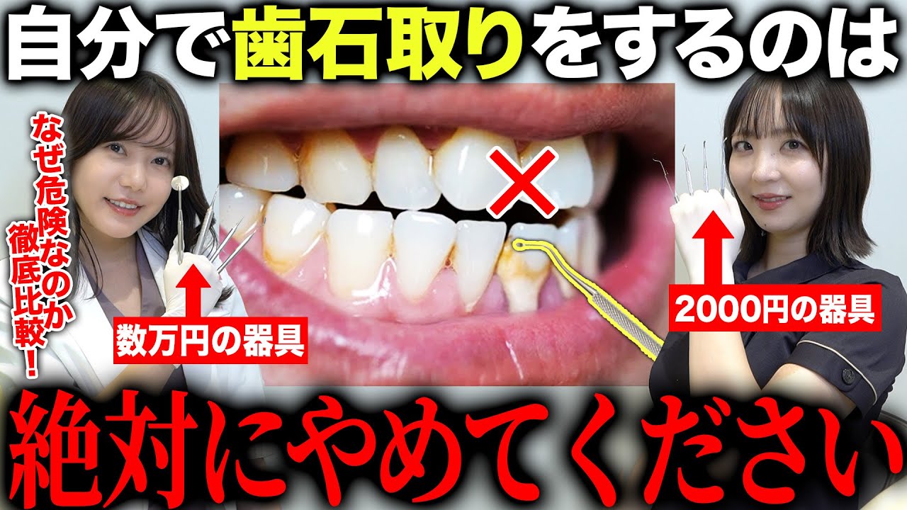 【絶対NG】市販のスケーラーで歯石を取ると起こる最悪の末路