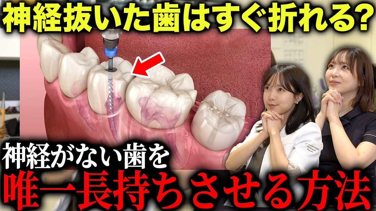 虫歯治療で神経を取った歯って5年後どうなるの？長持ちさせる人の共通点