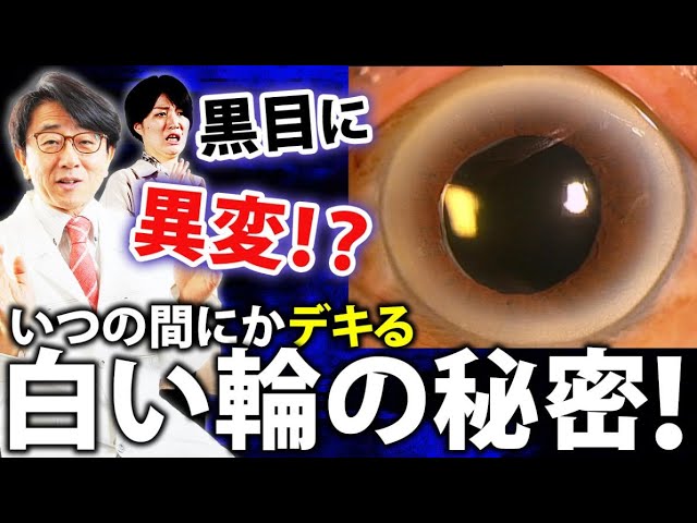 黒目の周りが白く濁って来ませんか？それ○○○です！