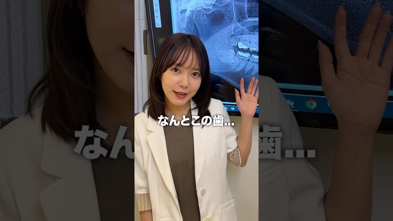 Q.このレントゲン虫歯何本あるでしょう？