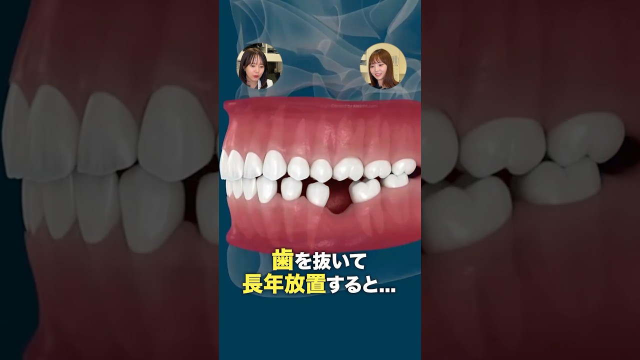 抜歯して治療しないと歯茎が腐るって本当！？