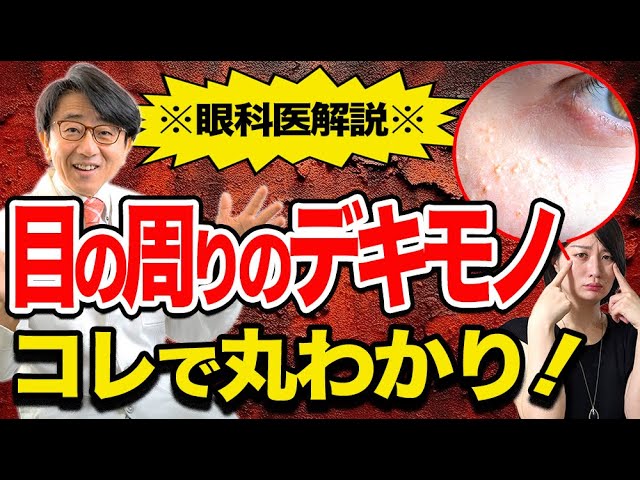 稗粒腫？霰粒腫？いろんなデキモノまるっと完全解説！