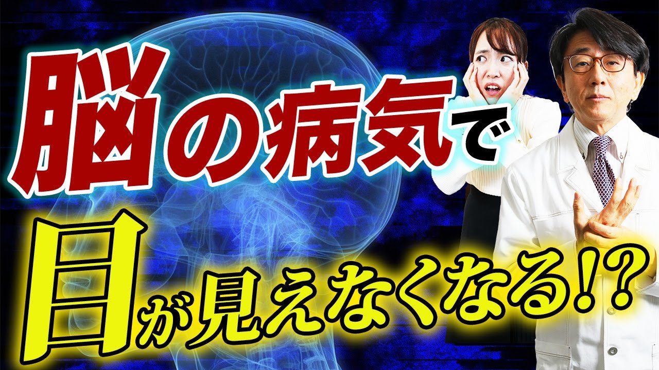 知らないと後悔する脳梗塞セルフチェック！