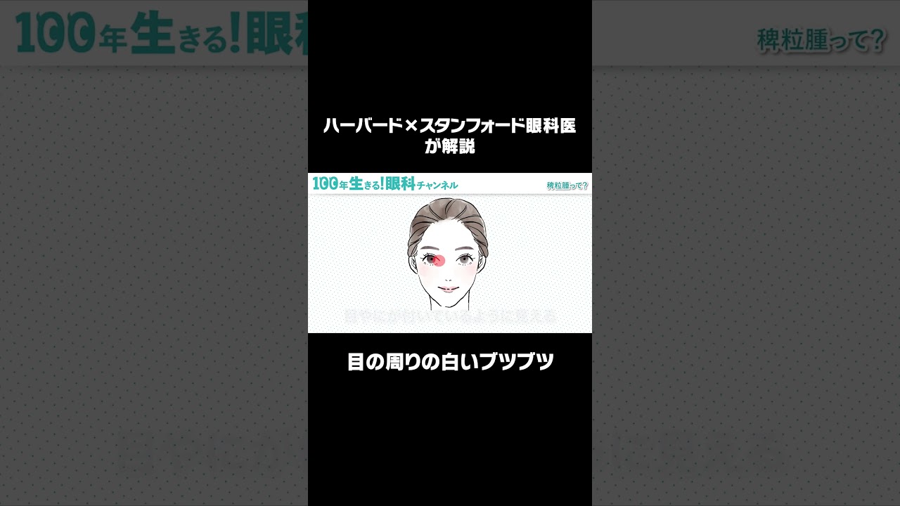 目の周りにできる白いブツブツ。これって病気？ #shorts