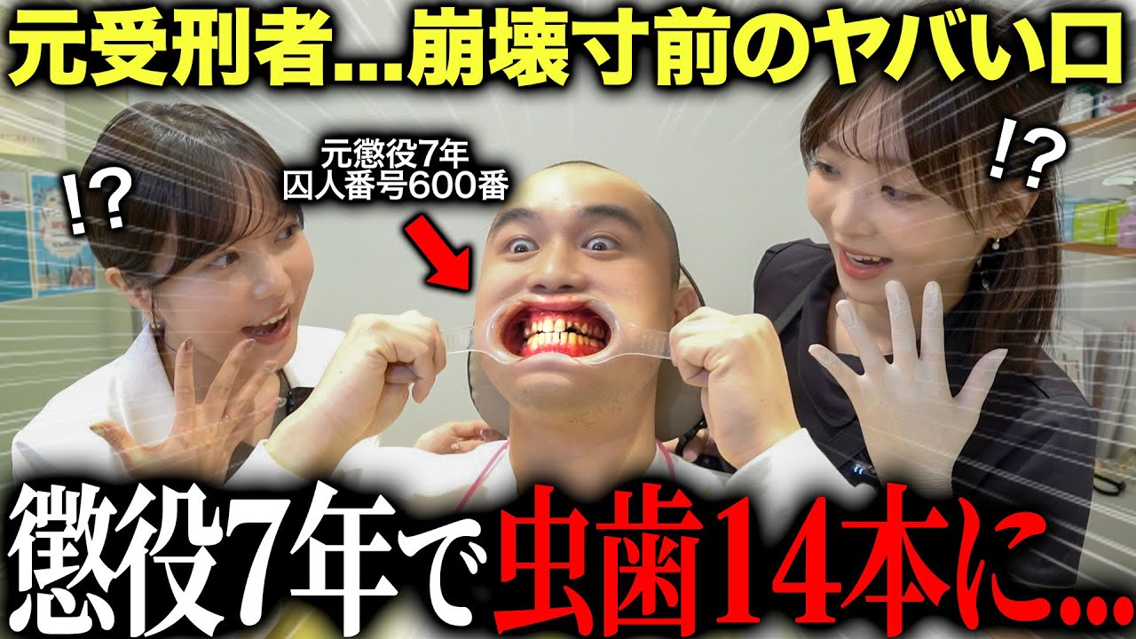 【元受刑者が来院】懲役7年の刑務所生活で口の中が“限界状態”に…虫歯14本になった理由