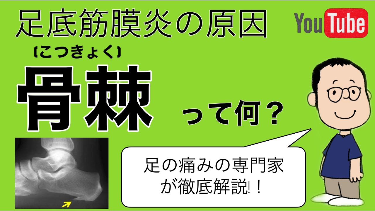 本当に骨棘が原因？足底筋膜炎と骨棘の関係性