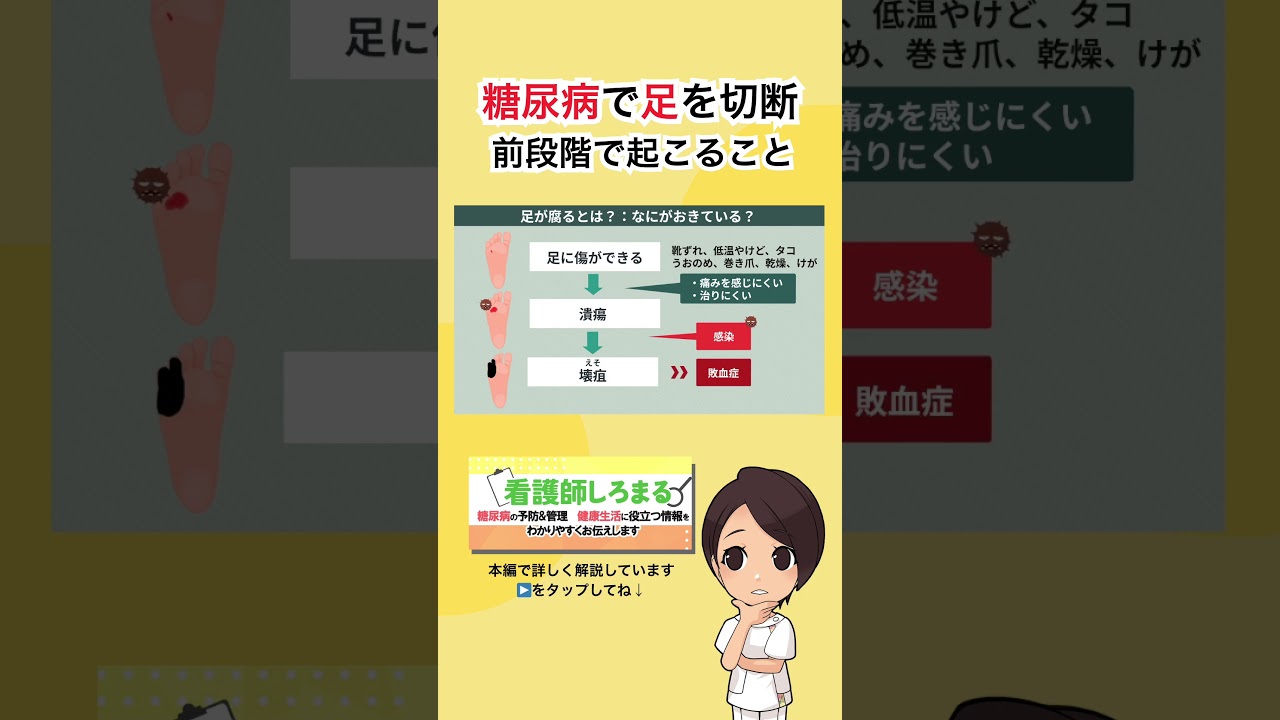 【糖尿病】足の壊疽はどのように起こるのか