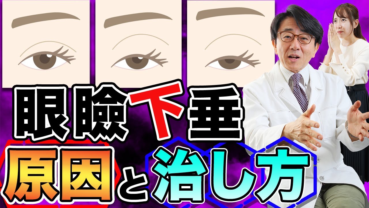 眼瞼下垂とは何か！？原因と治し方教えます。