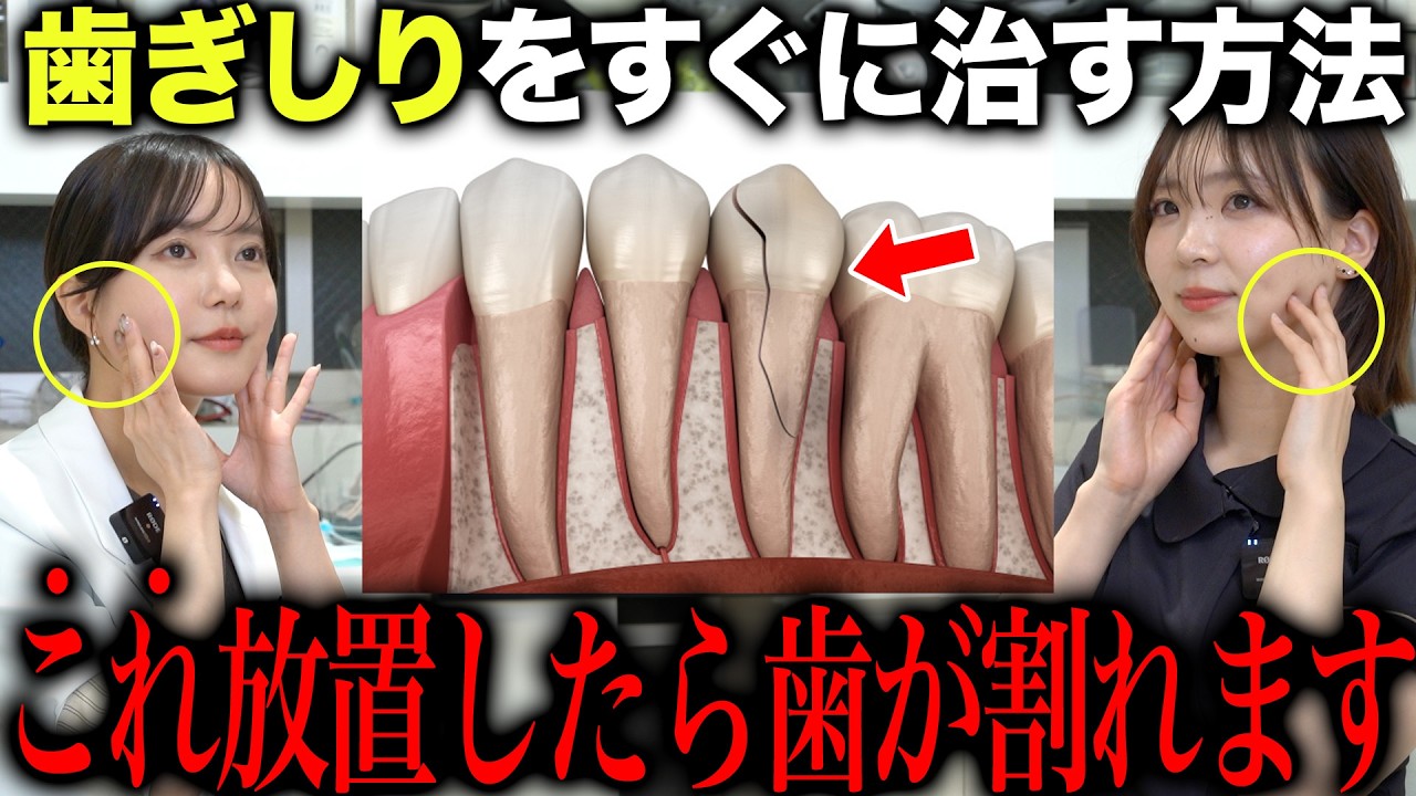 放置すると歯が壊れます。歯ぎしり・食いしばりの原因と改善法を歯医者が解説