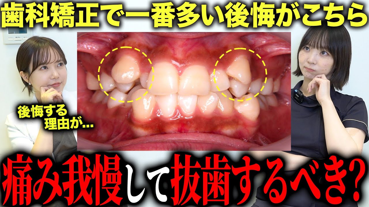 【歯列矯正の罠】その抜歯、本当に必要？後悔しない判断基準を歯医者が解説します