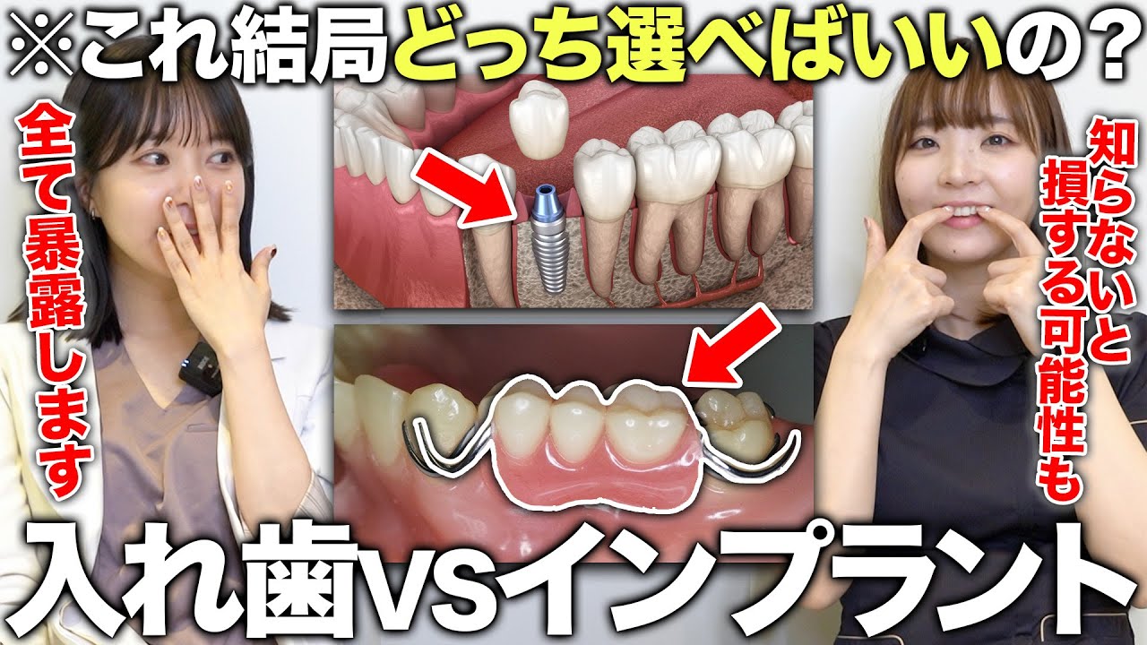 【実は日本人の20%が入れ歯!?】インプラントと入れ歯の費用やメリット&デメリットを歯医者が徹底解説！