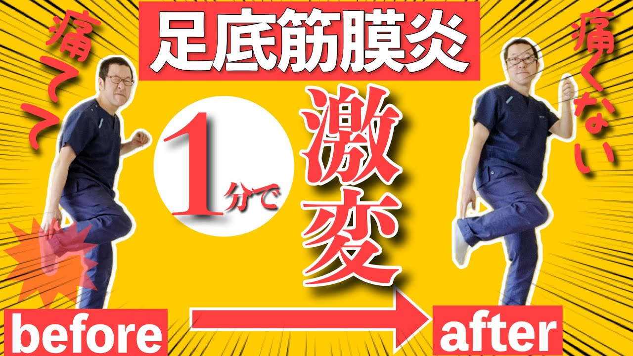 足底筋膜炎に抜群に効く！画期的セルフケアマッサージ