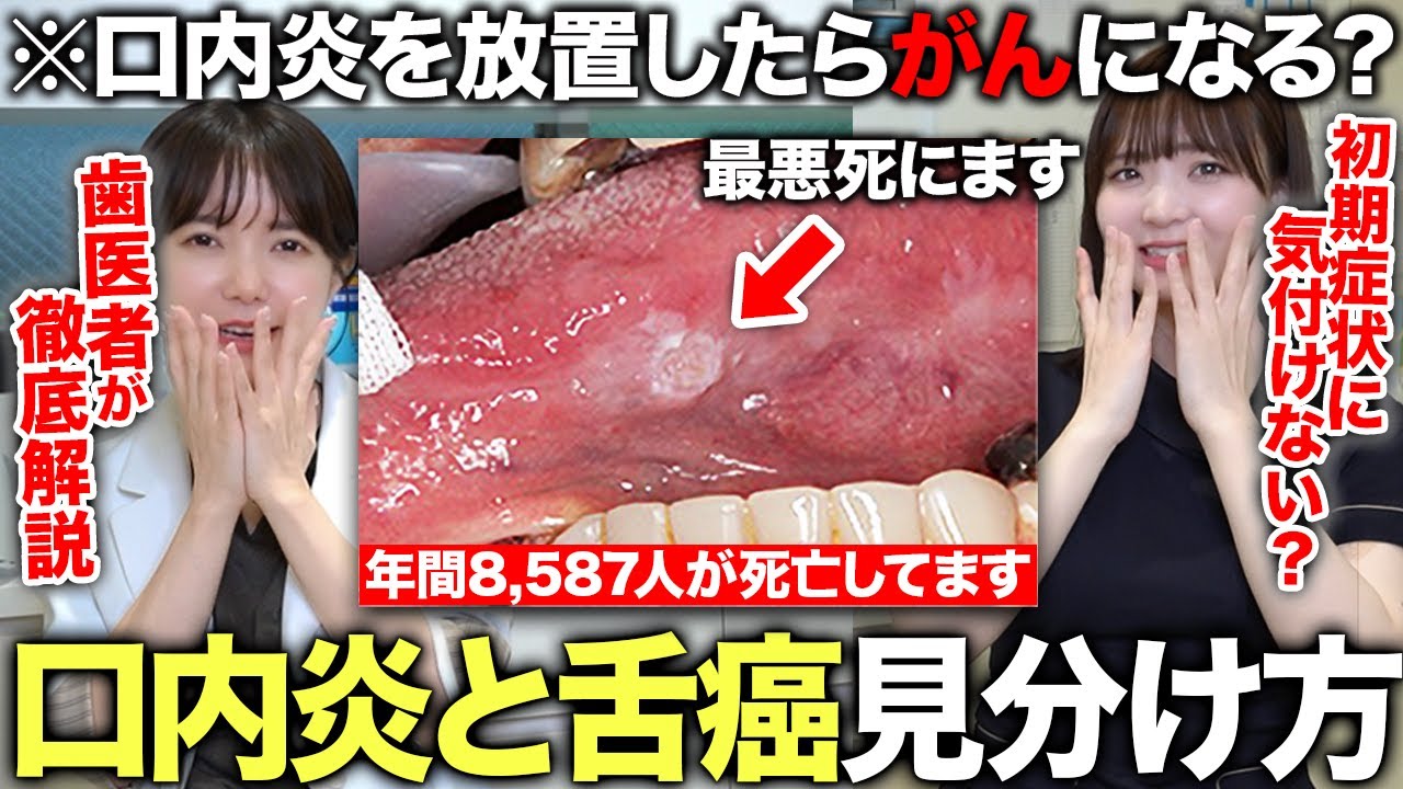 【絶対にコレやめて】口内炎を放置してたら口腔がんになる？予防法とこの症状に注意して！