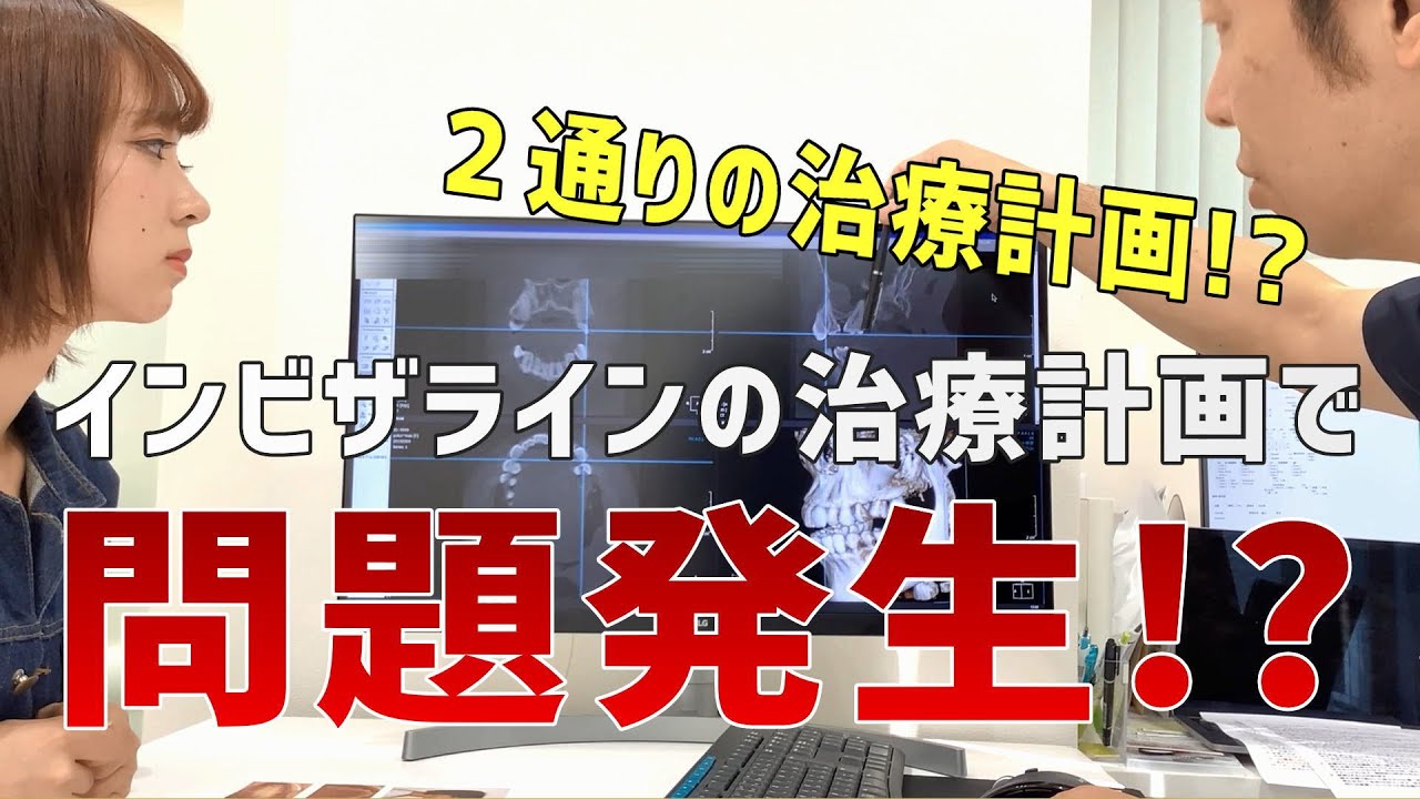 ②インビザライン矯正診断結果！治すのが大変な歯並びだった…！？