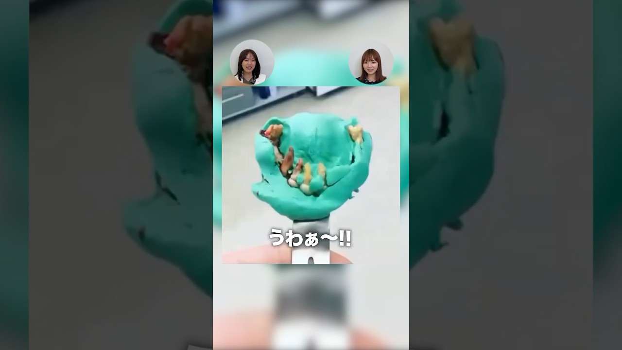 型取りしただけで歯が大量に抜けました…