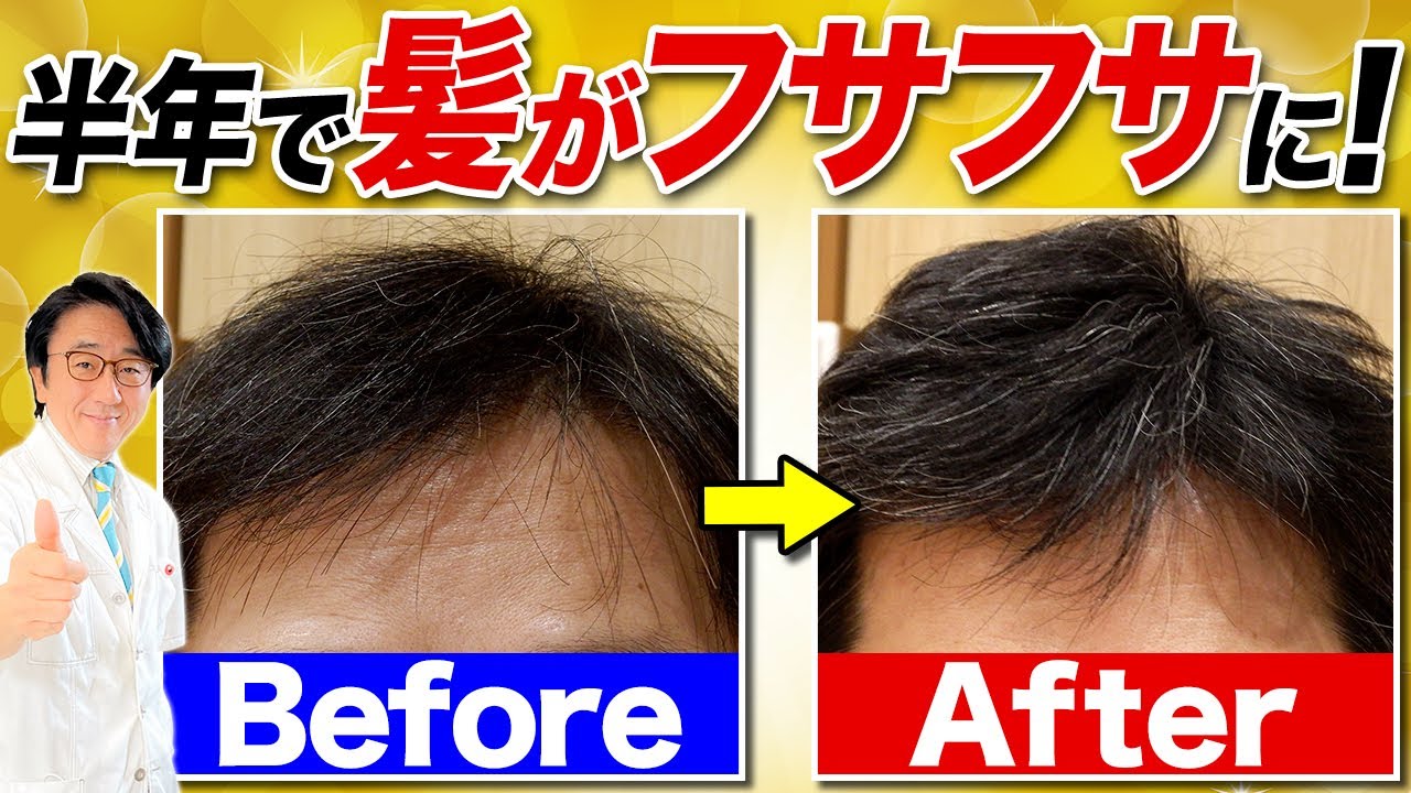 秋の抜け毛対策！これで髪が元気を取り戻します！