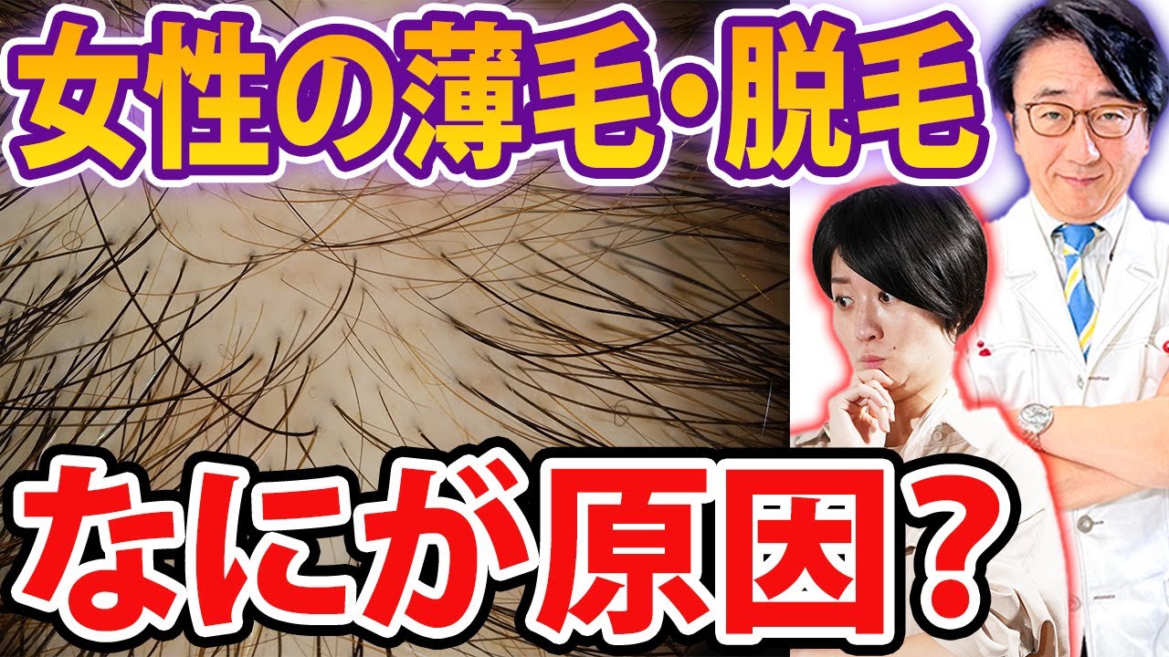 【薄毛治療】女性の抜け毛の原因はこれ！男性との違いについても解説します！