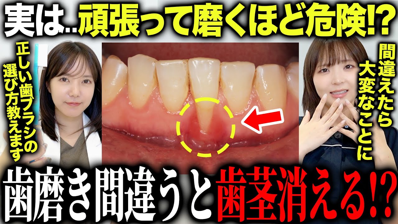 【危険!?】毎日やってる“歯磨き”が歯ぐきを傷つけてる!?｜歯医者が理由と対策を徹底解説
