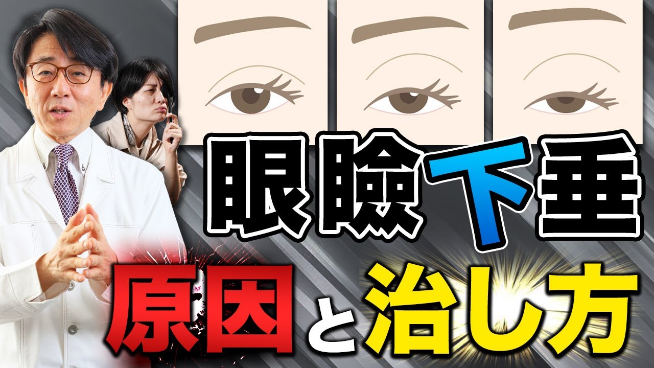 眼瞼下垂どうしてなるの？治し方は？眼科医が解説します！