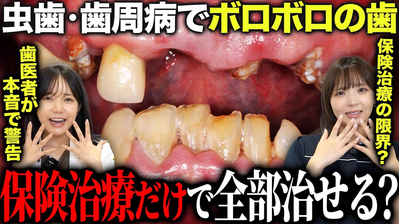 【警告】虫歯・歯周病で歯がボロボロに…保険治療だけでは助からない理由が…？
