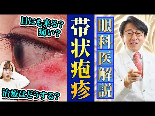 【3人に1人発症！？】帯状疱疹の原因、症状、治療法、目への影響を眼科医が徹底解説