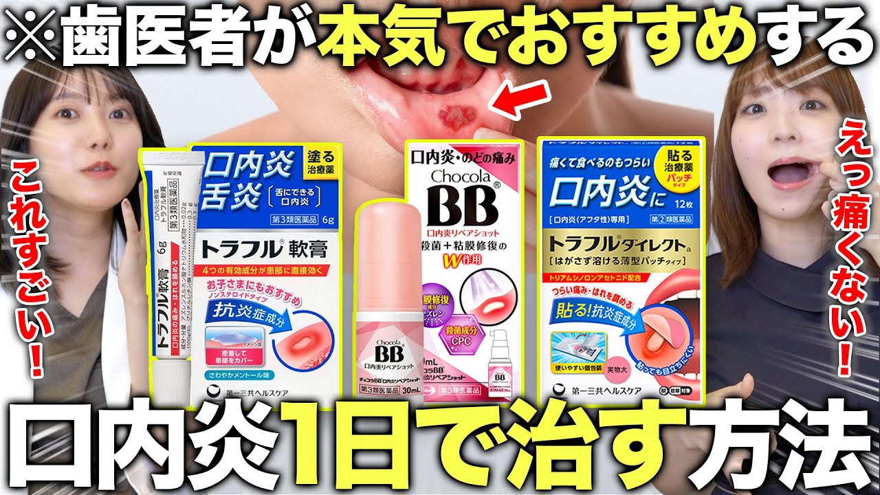激痛の口内炎がたった1日で消し去る！？即日治す方法と再発防止策を徹底解説！