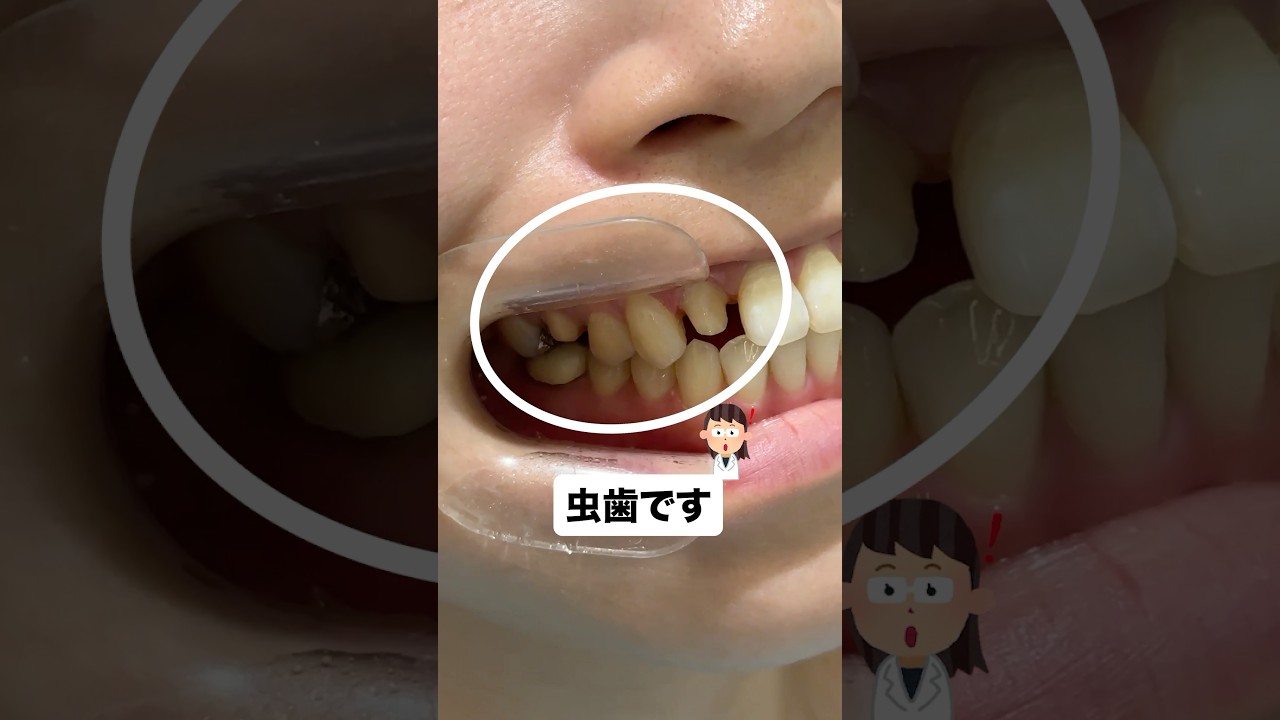 歯医者が嫌いだけど歯にコンプレックスある女性が…