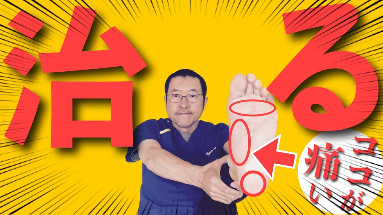 【足底筋膜炎】慢性化した足の痛みの治し方！”足底筋膜炎専門”京都コンディショニン