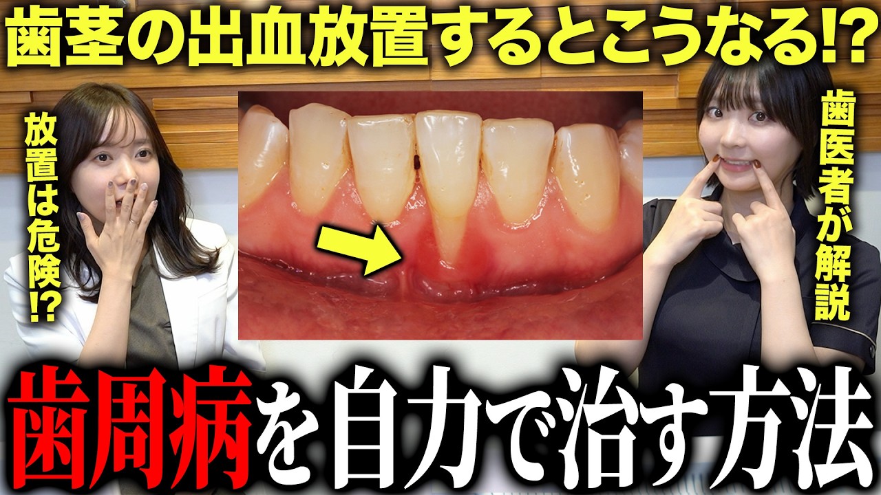 【歯医者が解説】炎症して出血する歯茎は自力で治せるのか？