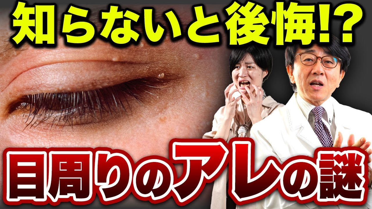 目の周りのデキモノ！眼科医が原因と治療についてお話します。