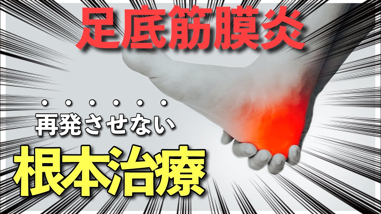 【再発させない】足底筋膜炎が完治する方法