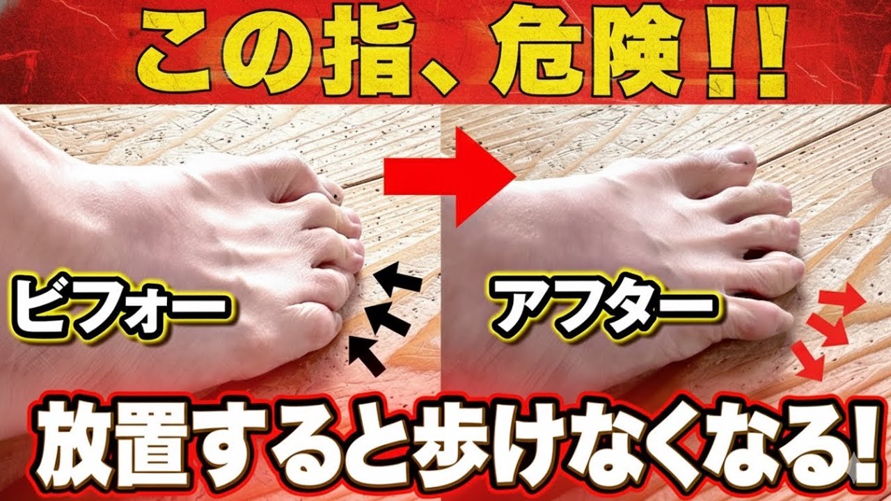【指が原因ではない！】毎日3分で“歩ける体”を取り戻すセルフケア